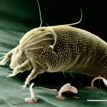 Science Art: <i>Rust Mite,</i> Aceria anthocoptes, by Erbe, Pooley: USDA, ARS, EMU. Science Art: <i>Rust Mite,</i> Aceria anthocoptes, by Erbe, Pooley: USDA, ARS, EMU.