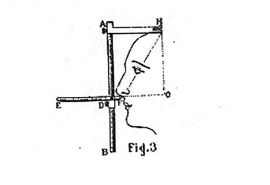 Fig 3 ThePocketCephalometer_LeBon