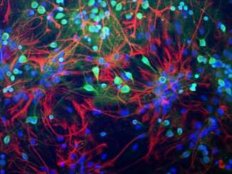 Scientific illustration of rat neurons stained with antibodies in green, red and blue.