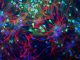 Scientific illustration of rat neurons stained with antibodies in green, red and blue.