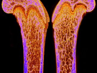 Scientific illustration of bones on the inside, from a CT scan.