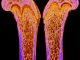 Scientific illustration of bones on the inside, from a CT scan.