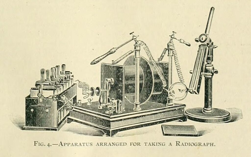 Scientific illustration of early X-ray equipment, including induction coil, battery, X-Ray tube, and fluorescent screen.