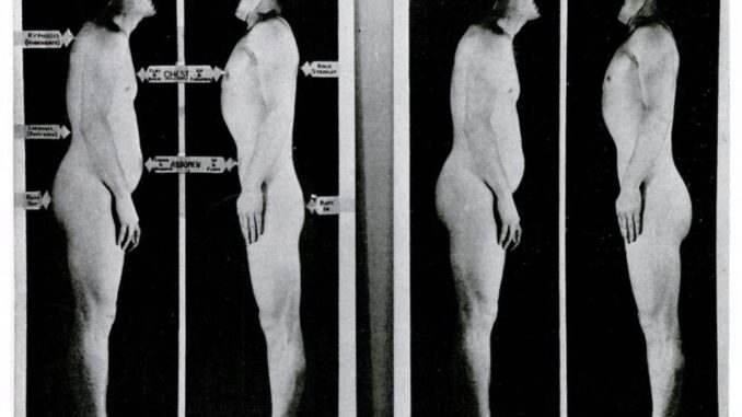 Scientific illustration of good posture versus slouching, with arrows pointing to various areas on the body.