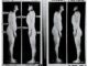 Scientific illustration of good posture versus slouching, with arrows pointing to various areas on the body.