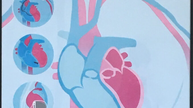 Scientific illustration of pacemakers, defibrillators, monitors, loop recorders, and other electronic devices inserted into the anatomically correct hearts.