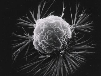 A cell, grey and lumpy, sends out white fibers against a black background.