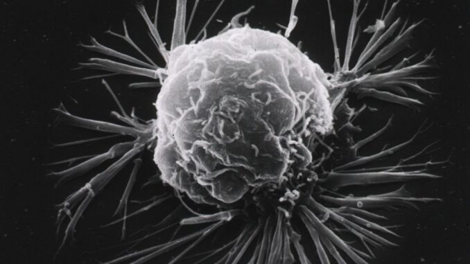 A cell, grey and lumpy, sends out white fibers against a black background.