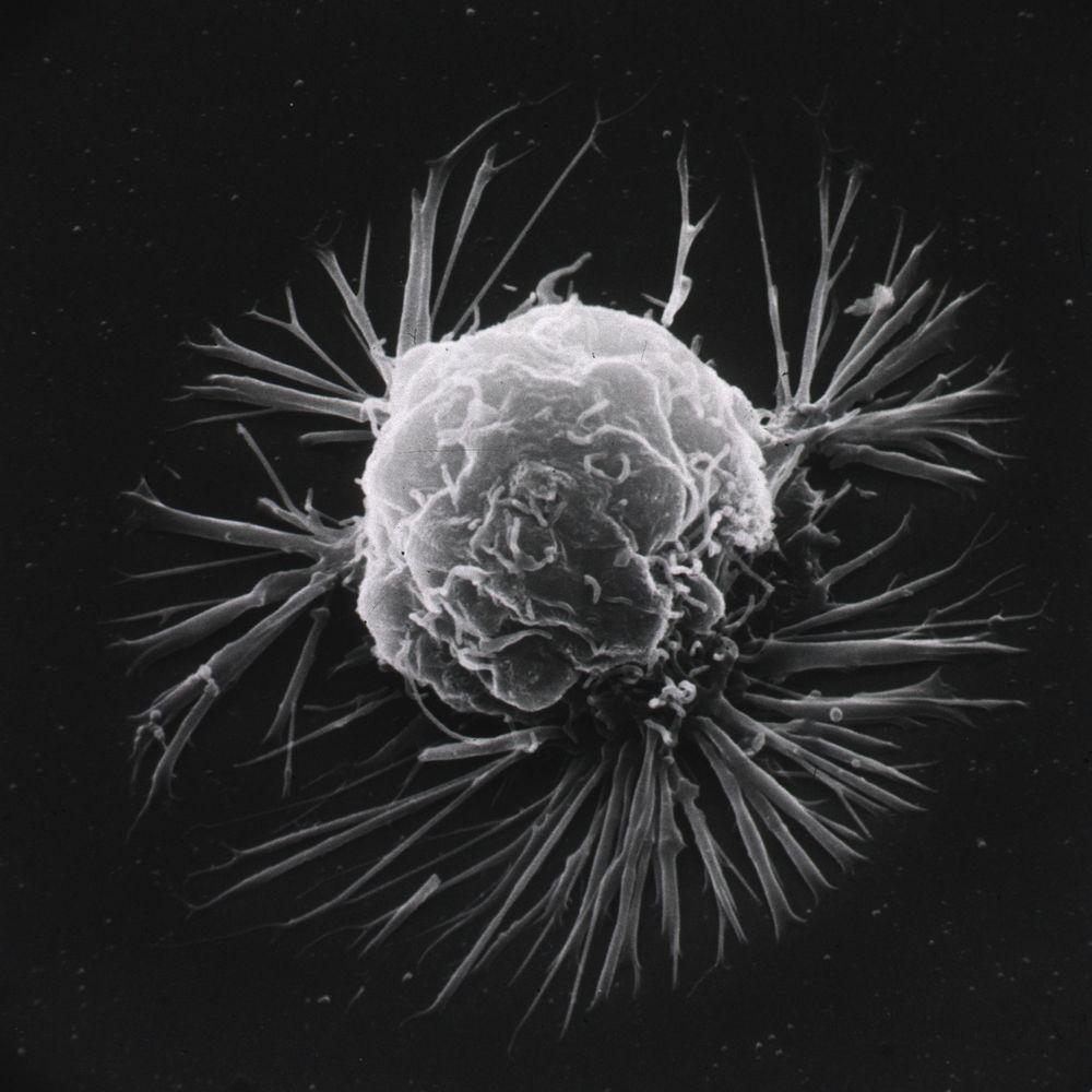 A cell, grey and lumpy, sends out white fibers against a black background.
